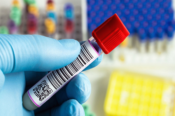 What You Need To Know About Antibody Testing For Covid 19